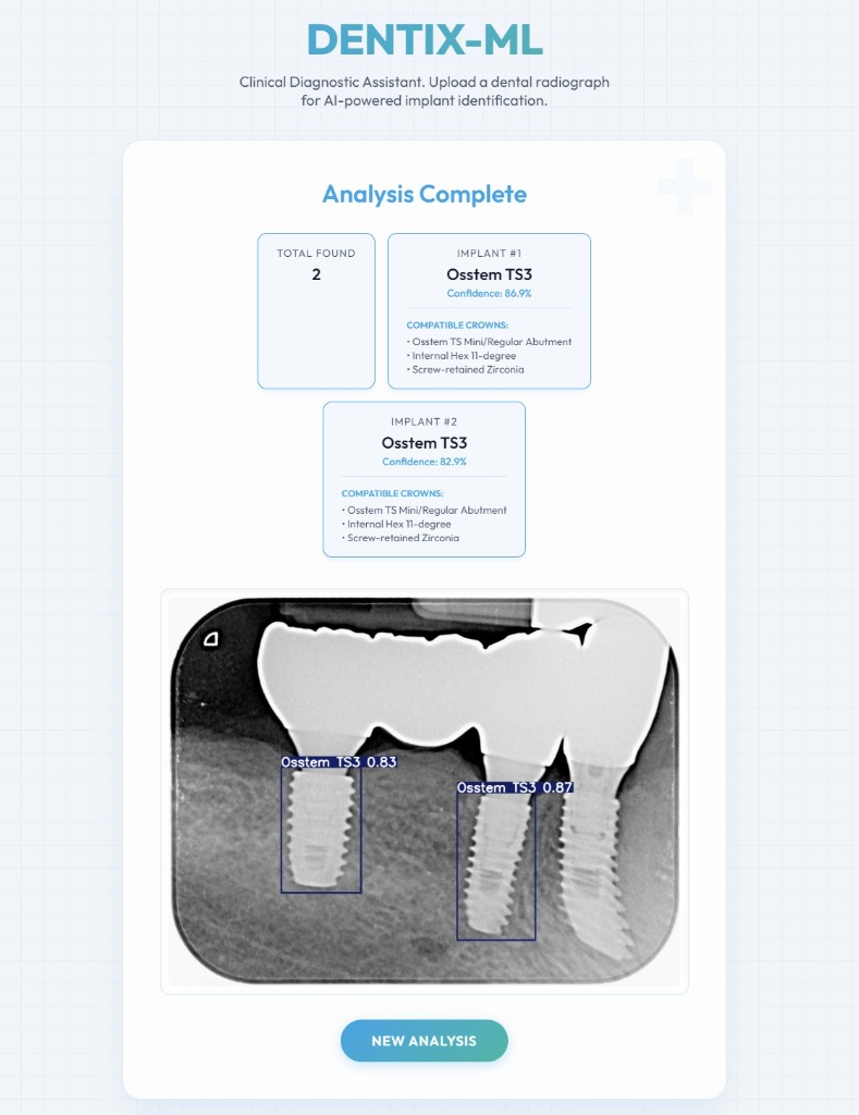 DENTIX-ML Analyzer Workspace Preview